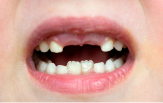 Pediatric dentist specialties in Kansas City, Mo