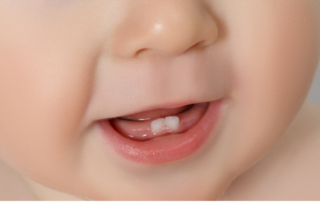 Pediatric dental specialists in Kansas City