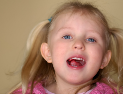 How to Prevent Children’s Gum Disease?