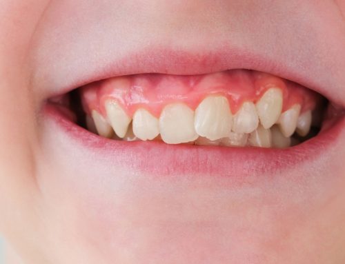 What Should You Do If Your Child Knocks a Tooth Loose?